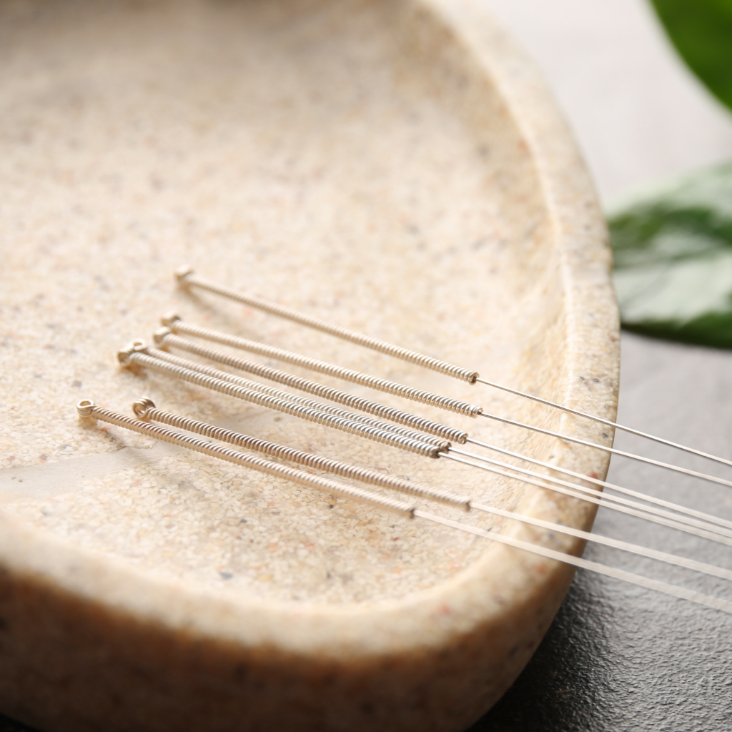 advanced acupuncture christchurch