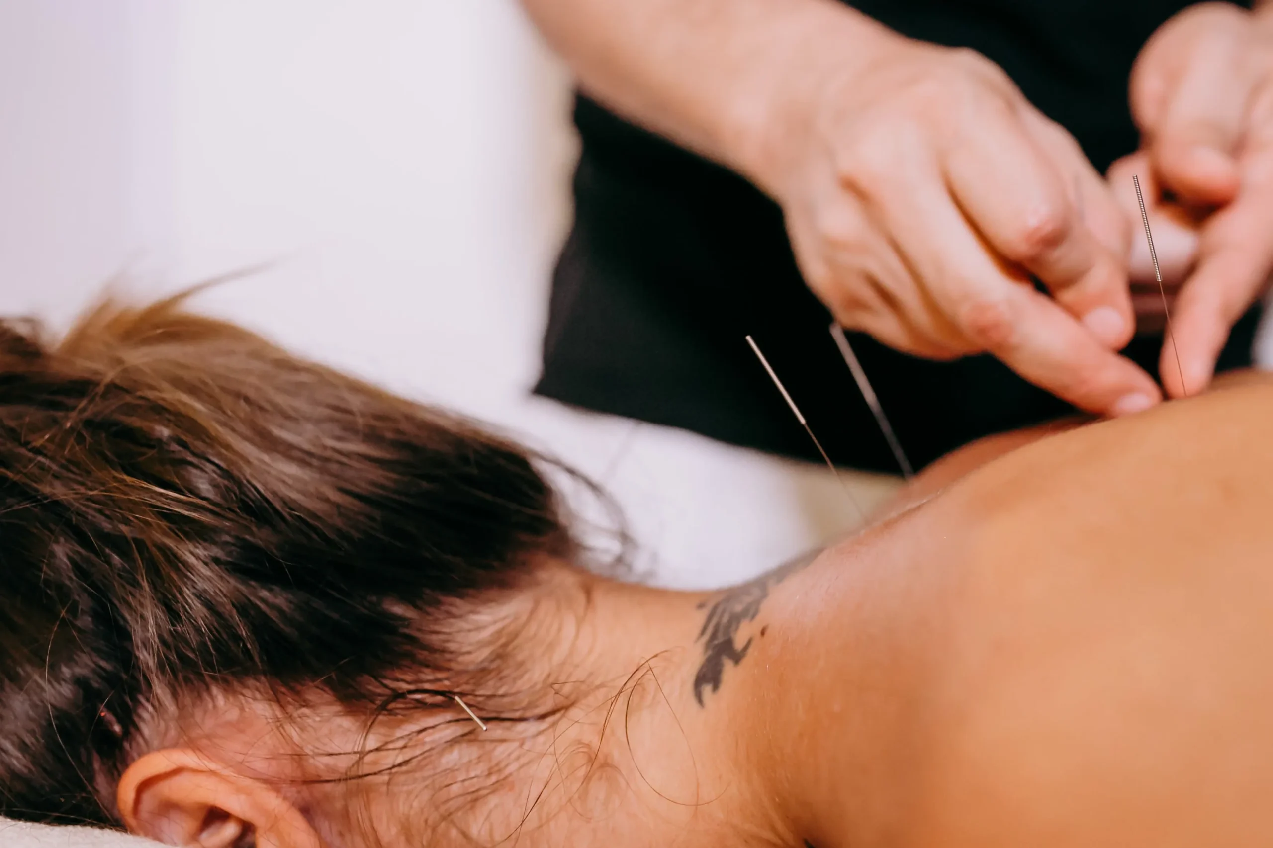 Advanced Acupuncture Christchurch: Professional Natural Healing Across Multiple Clinics